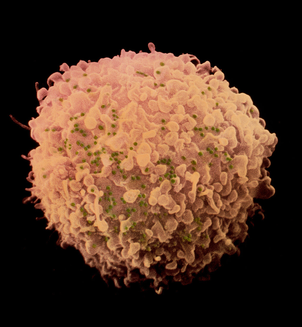 False-colour SEM of T-lymphocyte infected with HIV