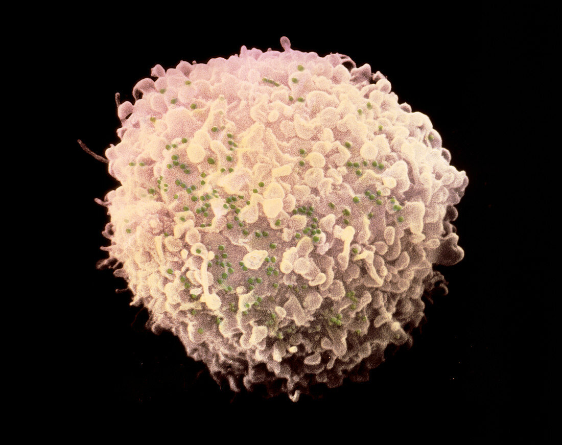 Coloured SEM of T-cell infected with AIDS virus