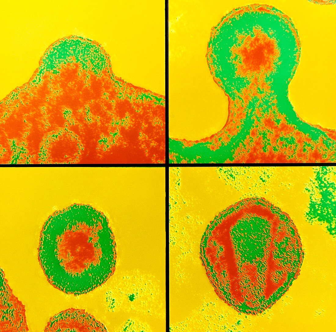 False-colour TEM of AIDS virus particle formation