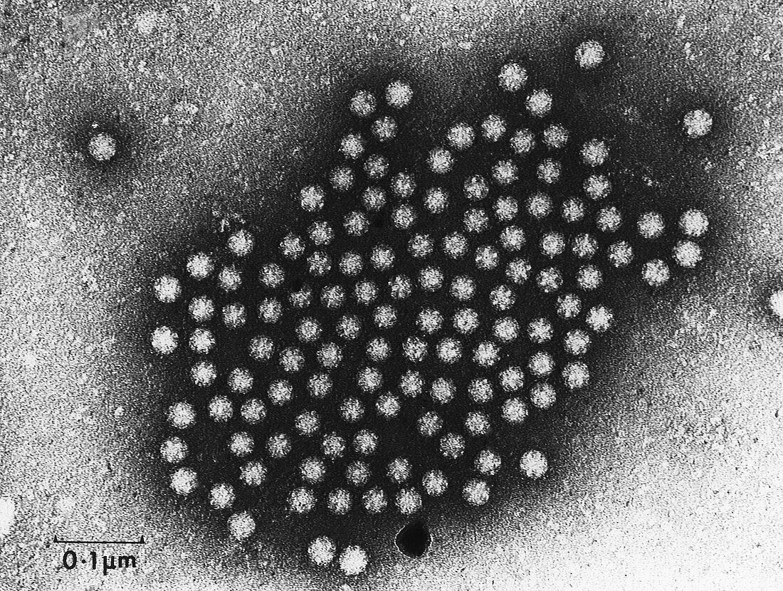 TEM of astrovirus particles