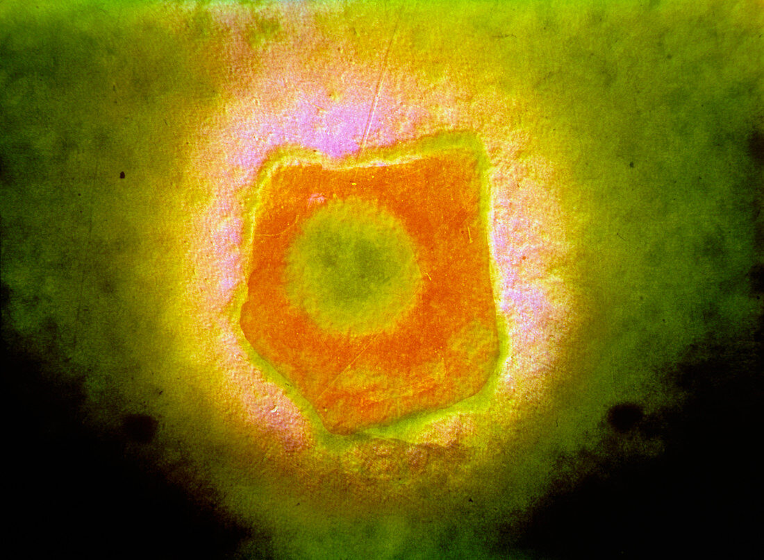 False-colour TEM of an Epstein-Barr virus particle