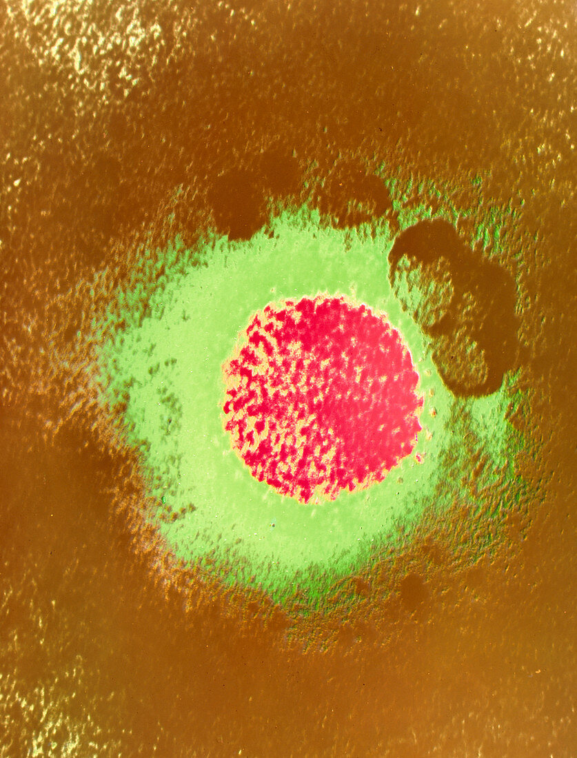 Coloured TEM of Lassa fever virus