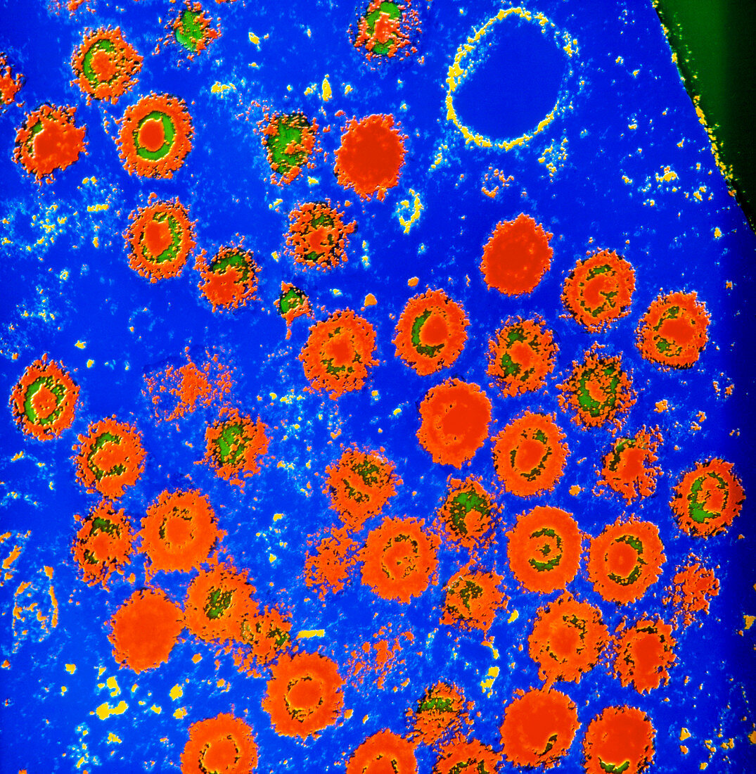 Coloured SEM of herpes simplex virus
