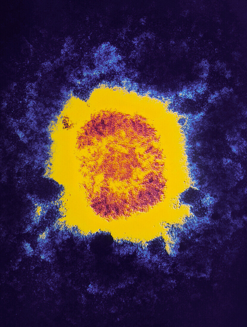 Coloured TEM of vaccinia virus particle