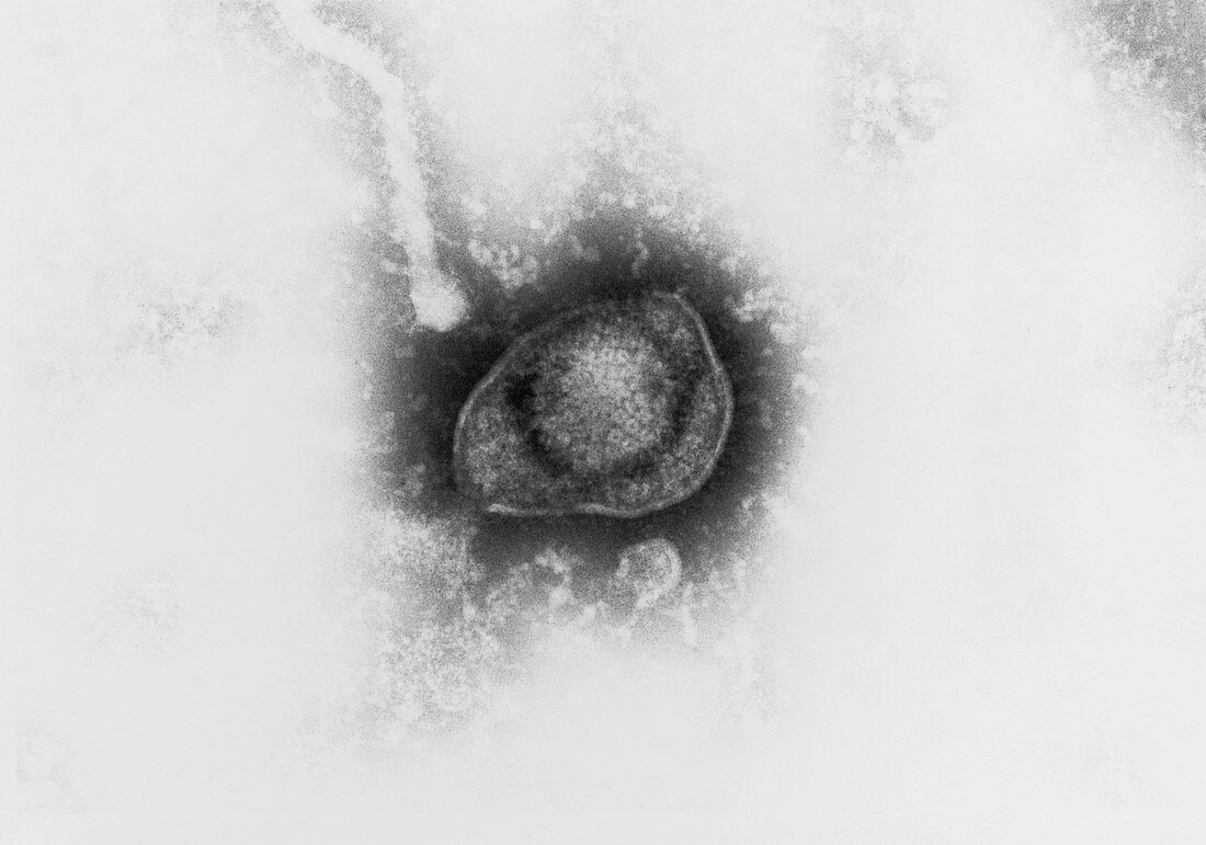 TEM of the Herpes Simplex virus