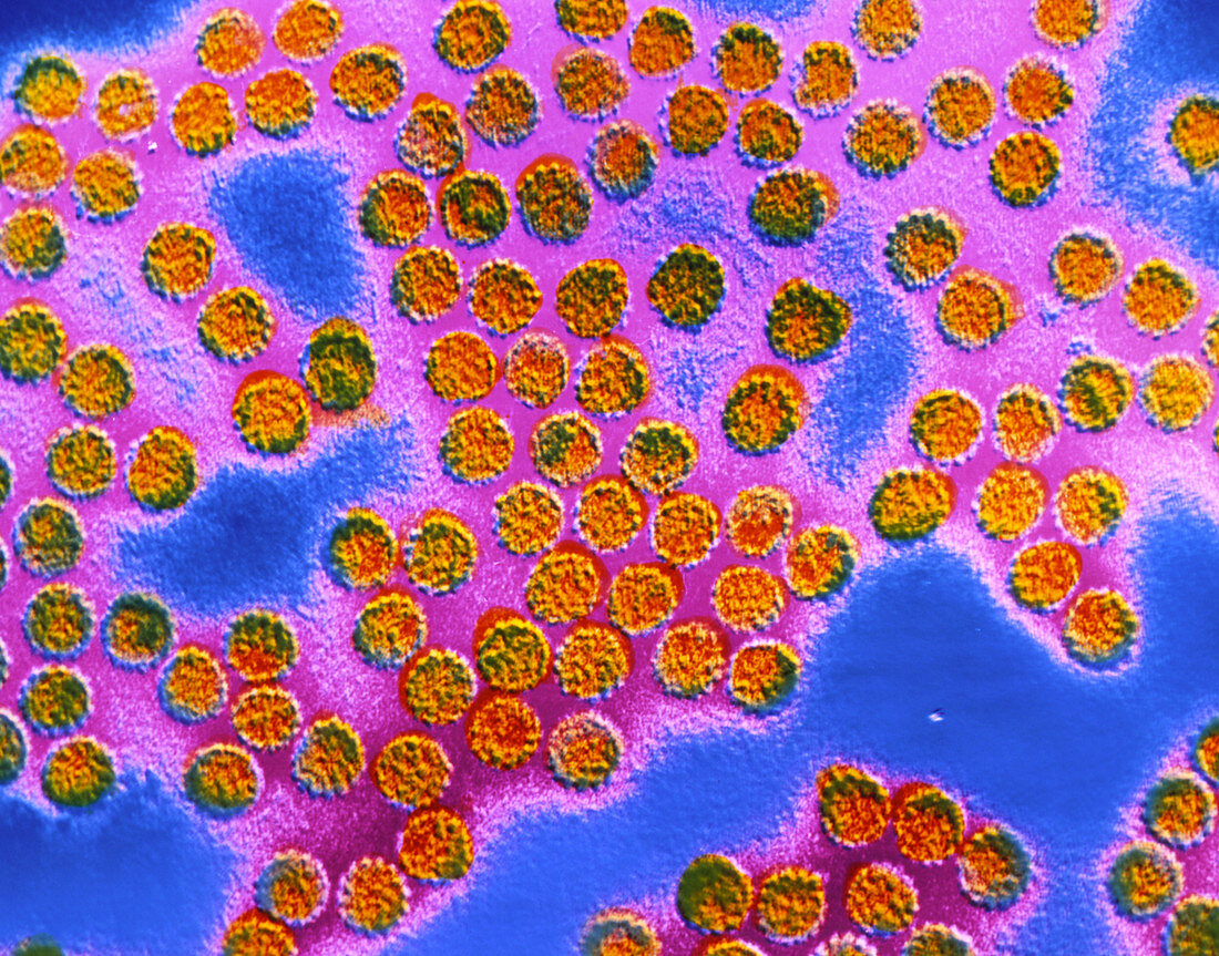 TEM of papilloma viruses