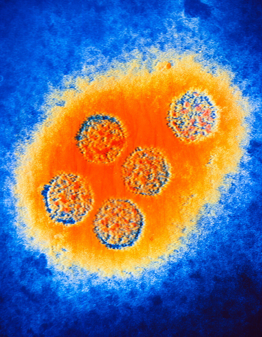 False-colour TEM of the Herpes Simplex virus