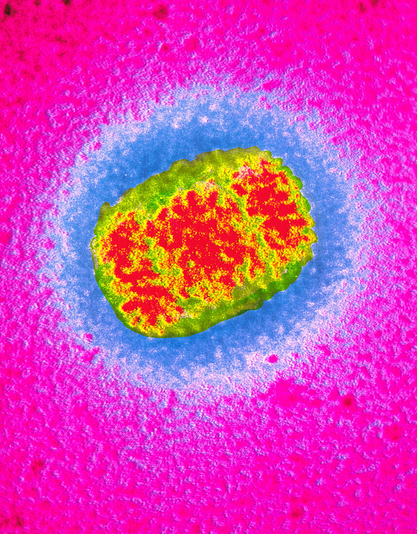 False-colour TEM of vaccinia virus particle
