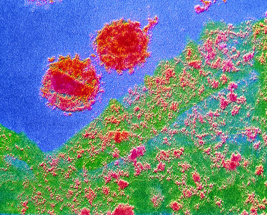 False-colour TEM of AIDS virus,HIV-2