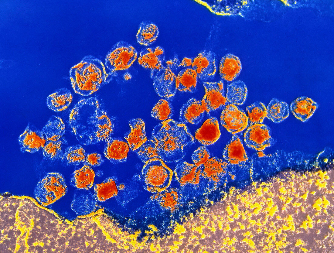 Coloured TEM of T-lymphocyte infected with HTLV-I