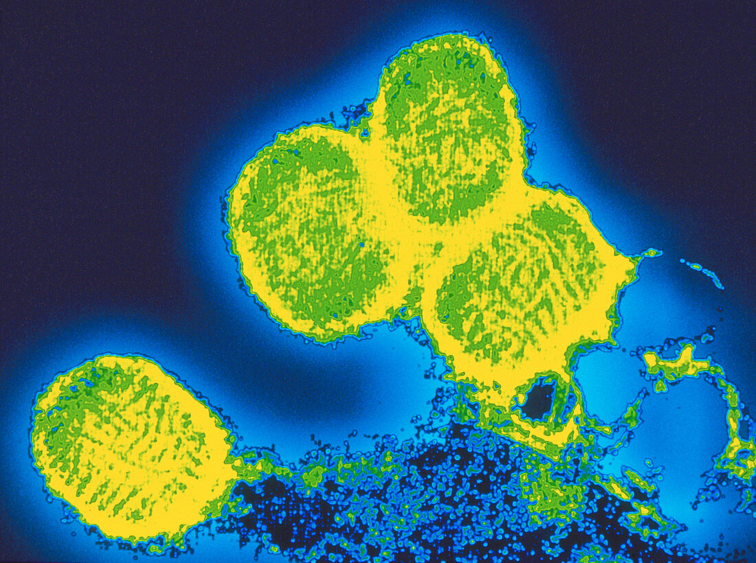 Coloured TEM of smallpox variola viruses