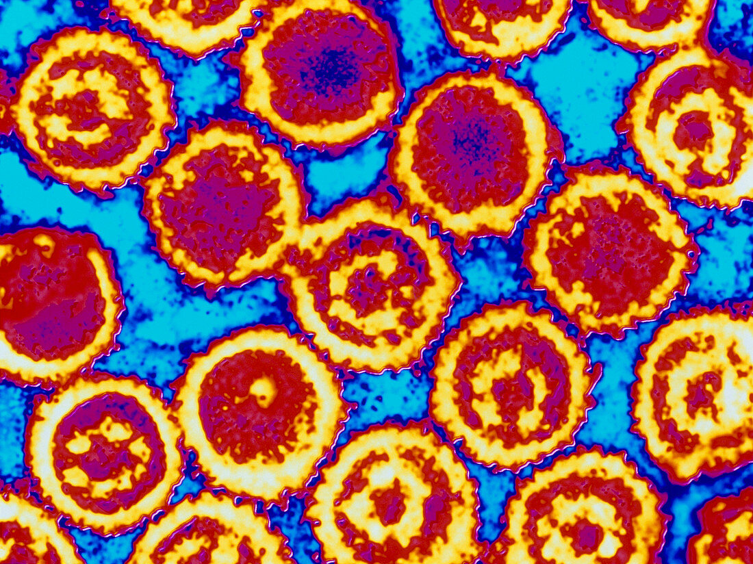 Coloured TEM of Epstein-Barr viruses