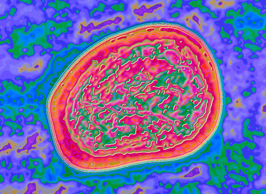 Coloured TEM of mumps virus,Rabula inflans