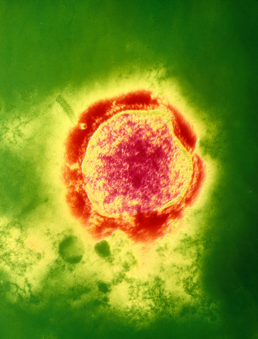 Coloured TEM of the measles virus