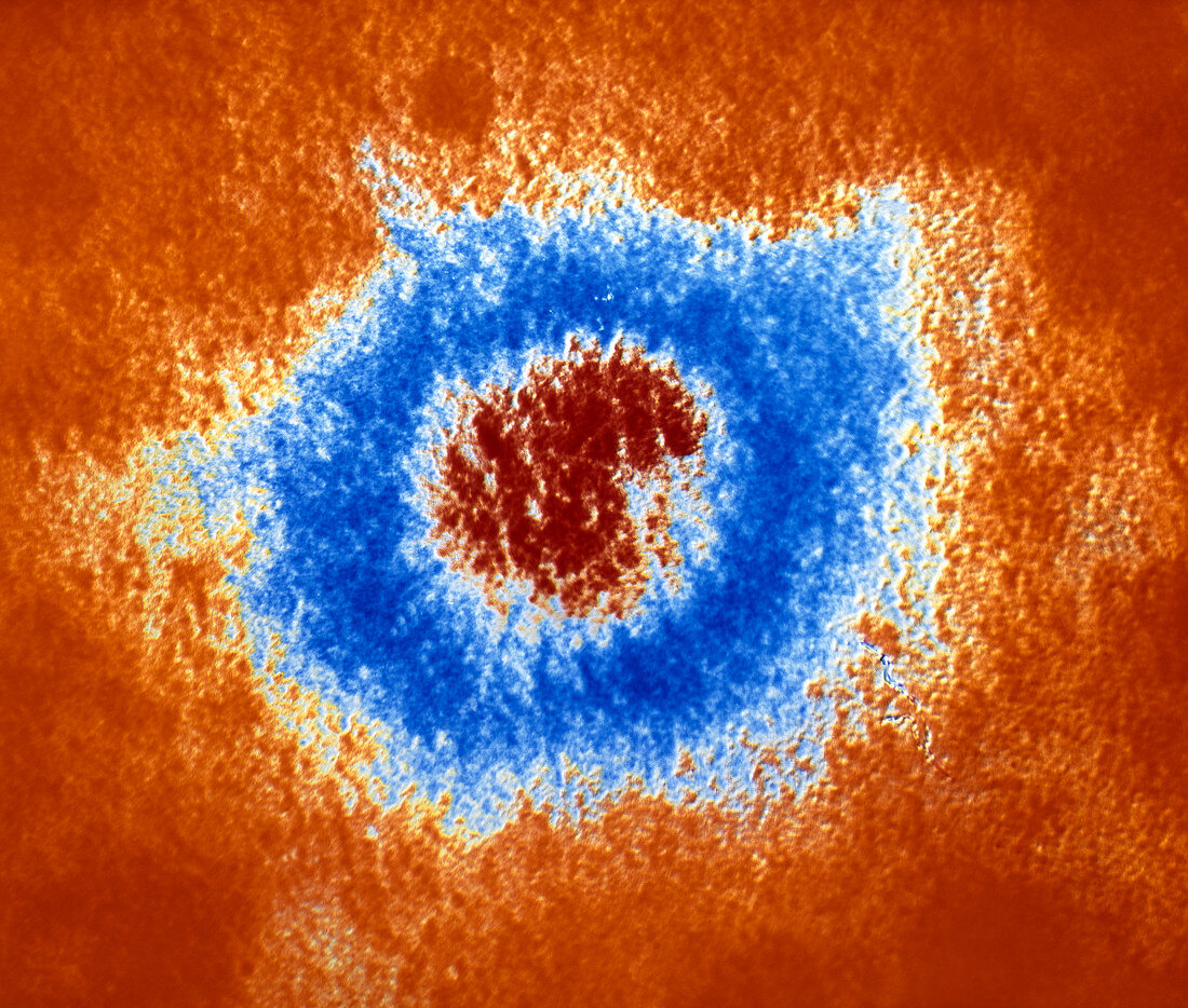 Coloured TEM of the Herpes Simplex virus