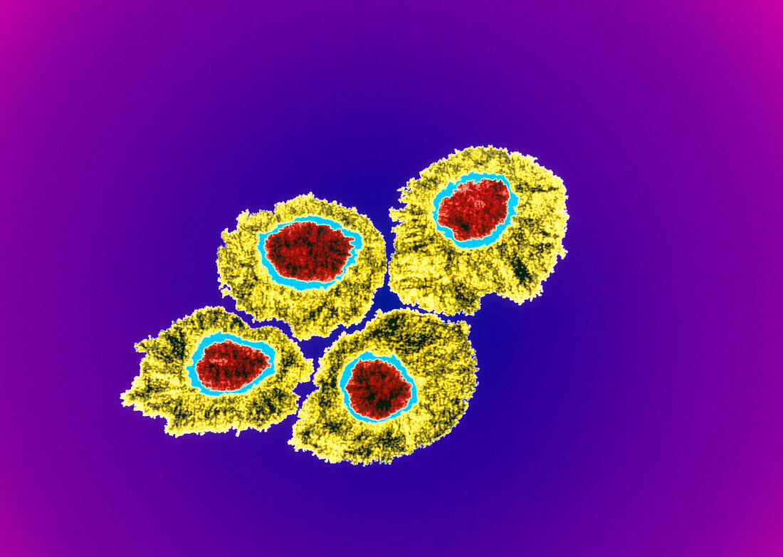 Transmission electron micrograph of herpes viruses