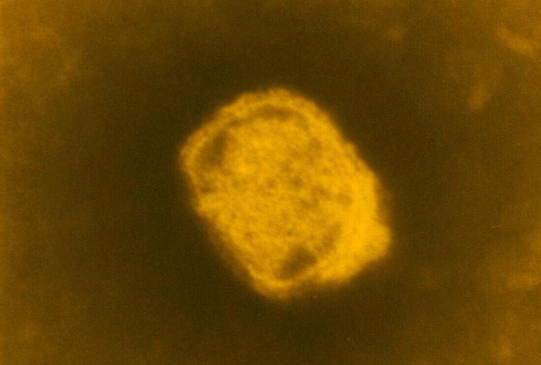 Tinted TEM of variola (smallpox) virus