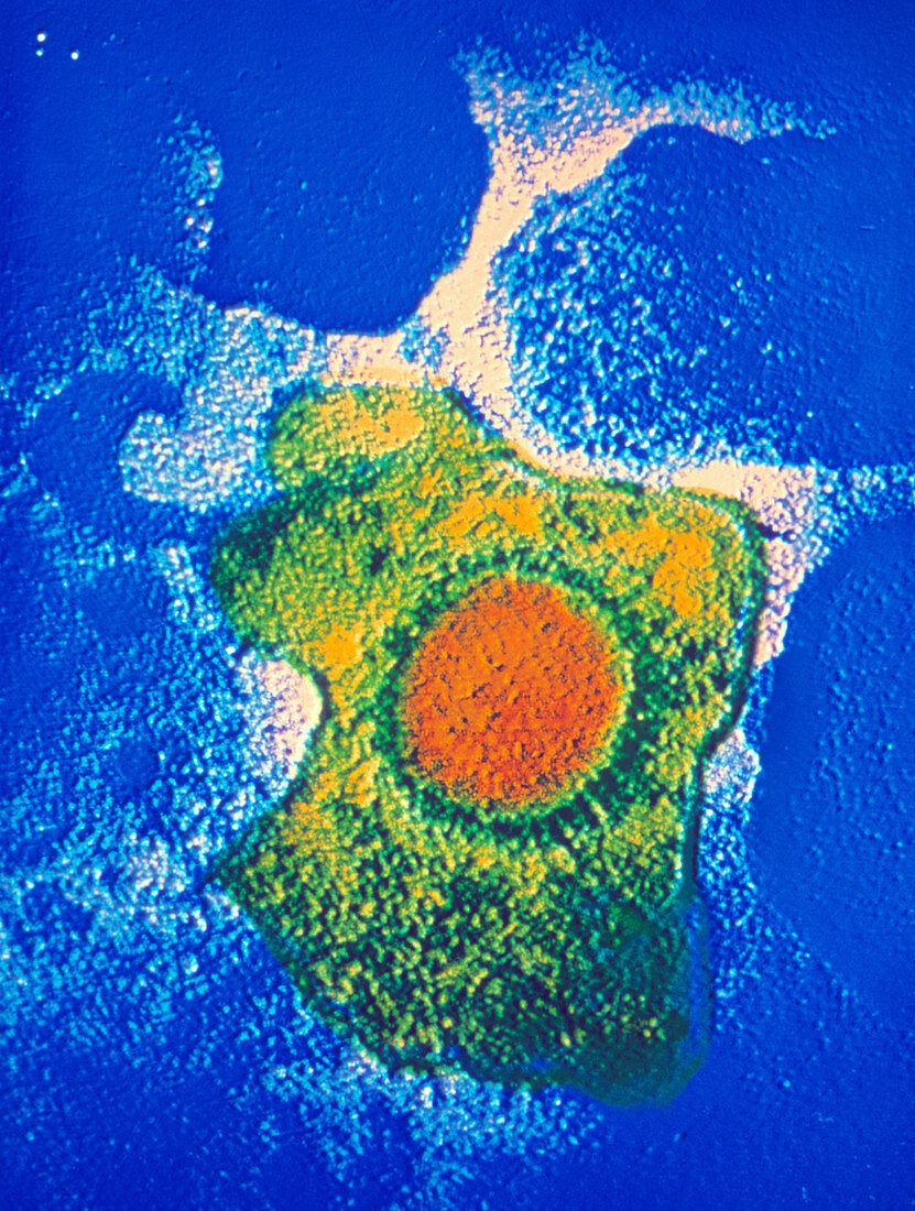 False-colour TEM of a Cytomegalovirus