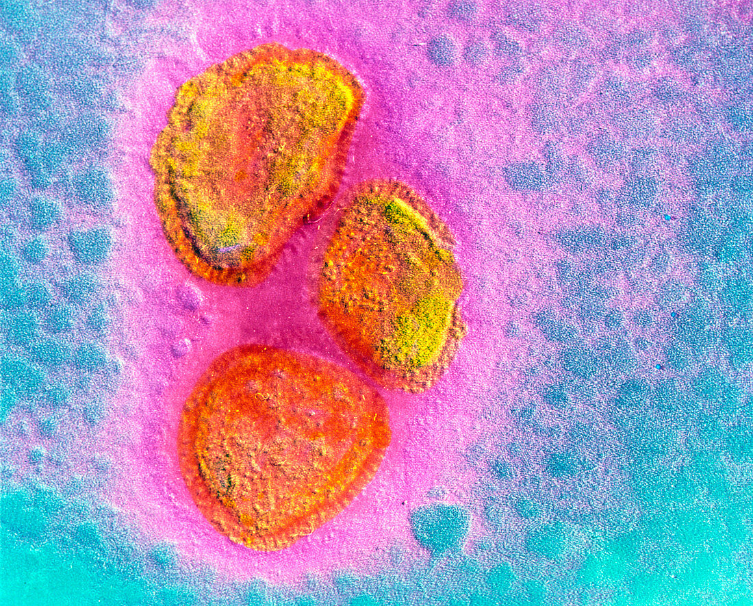 False-colour TEM of mumps virus particles