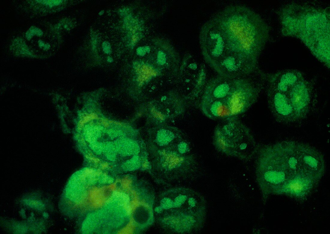 Fluorescent LM of cells showing Cytomegalovirus