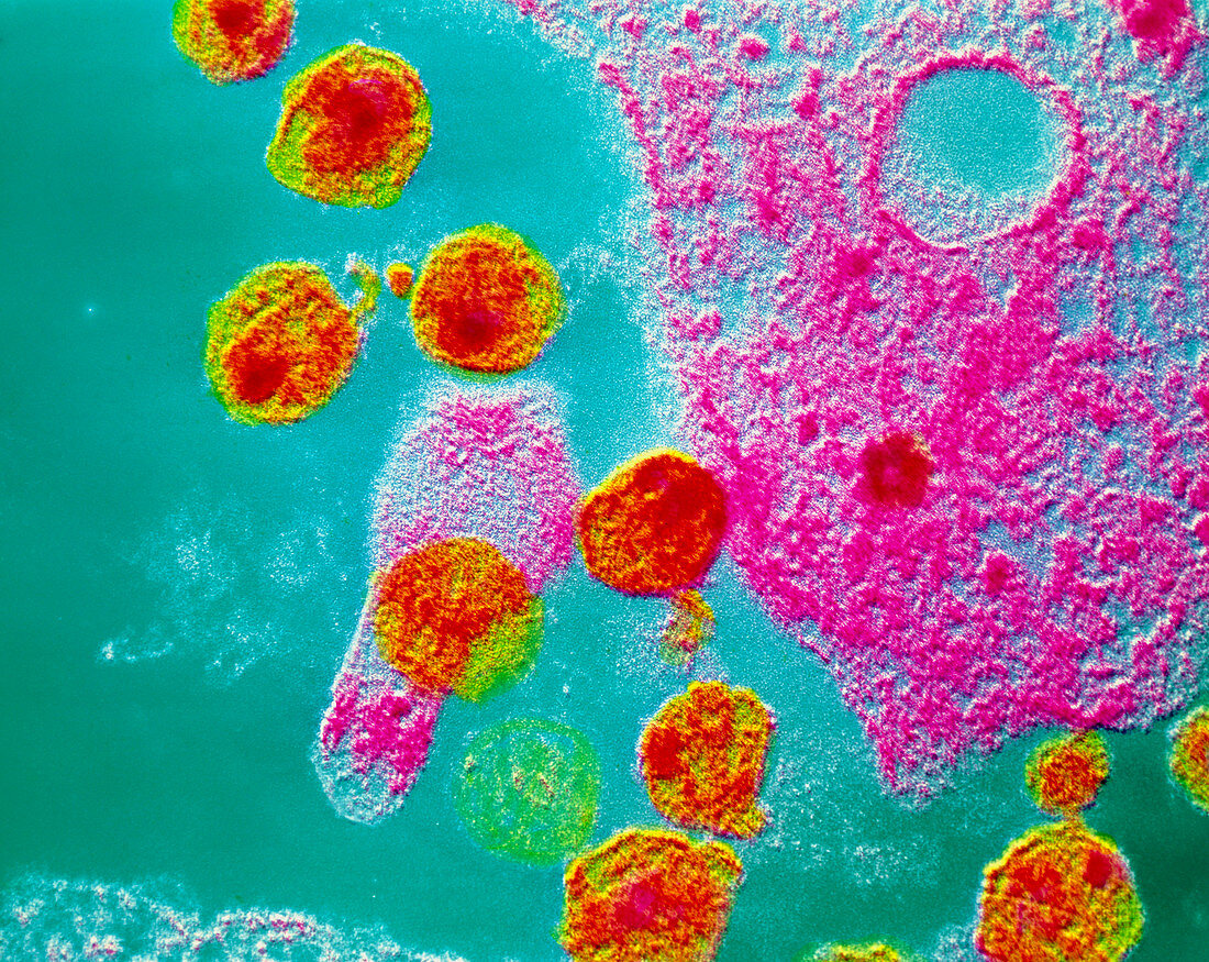 False-col TEM of AIDS virus inside T-cell