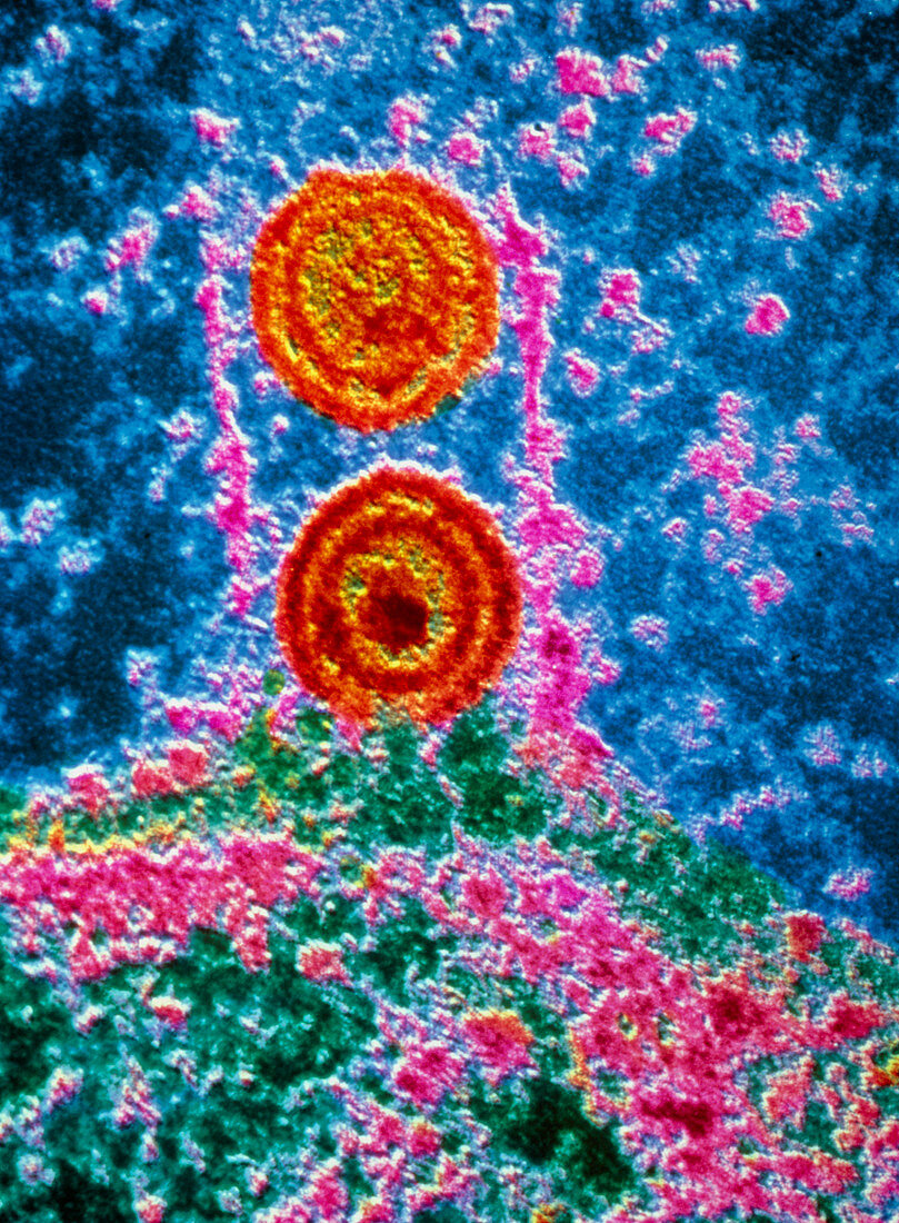 False-colour TEM of herpes simplex virus