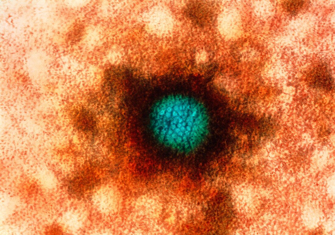 Herpes simplex virus,TEM