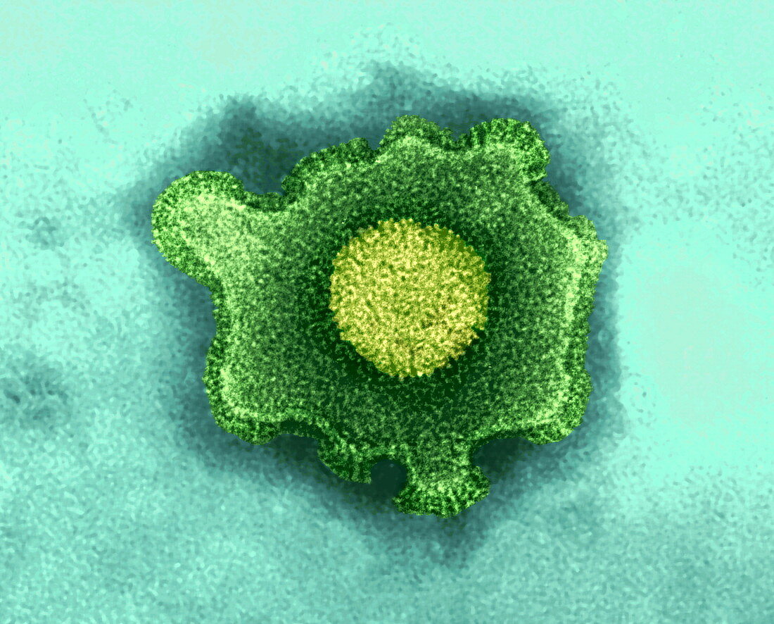 Herpesvirus,TEM