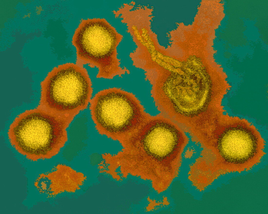 Rift Valley fever virus,TEM
