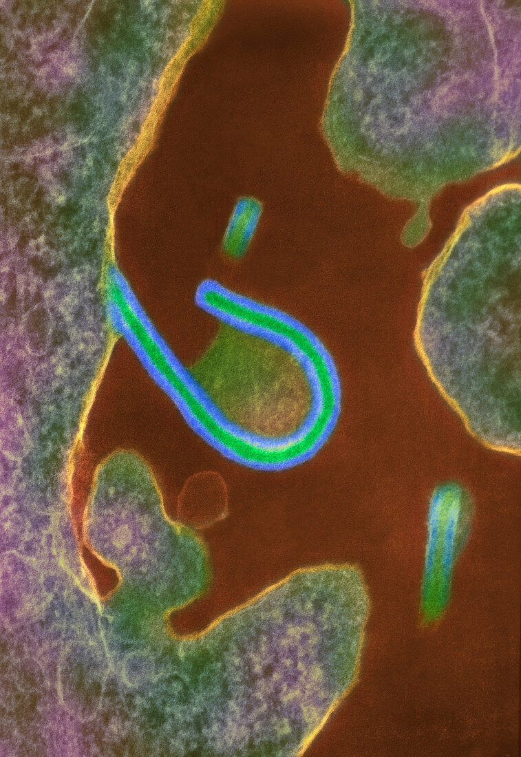 Ebola virus,TEM