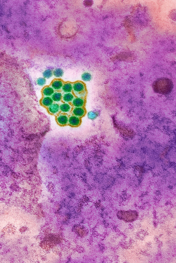 Yellow fever virus particles,TEM