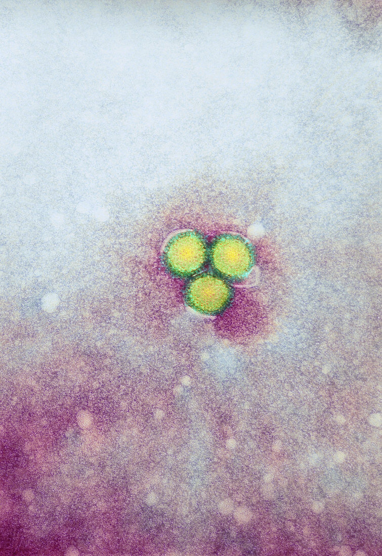 Rift Valley fever virus,TEM