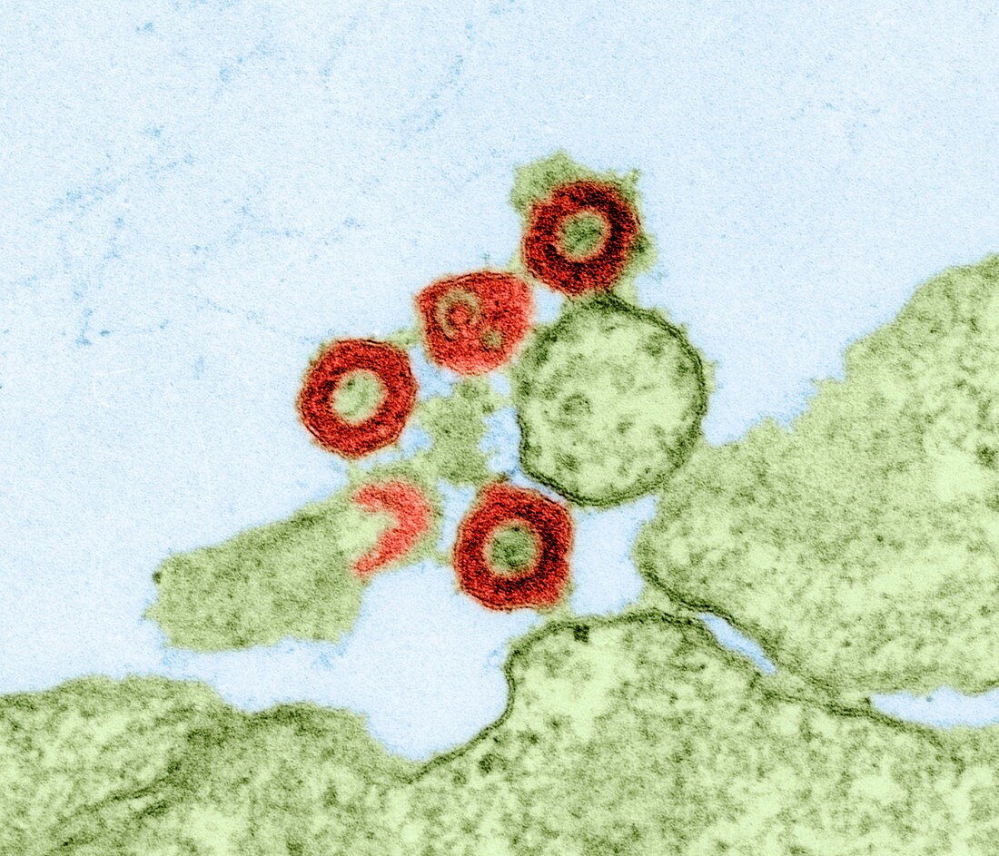 Human retrovirus,TEM