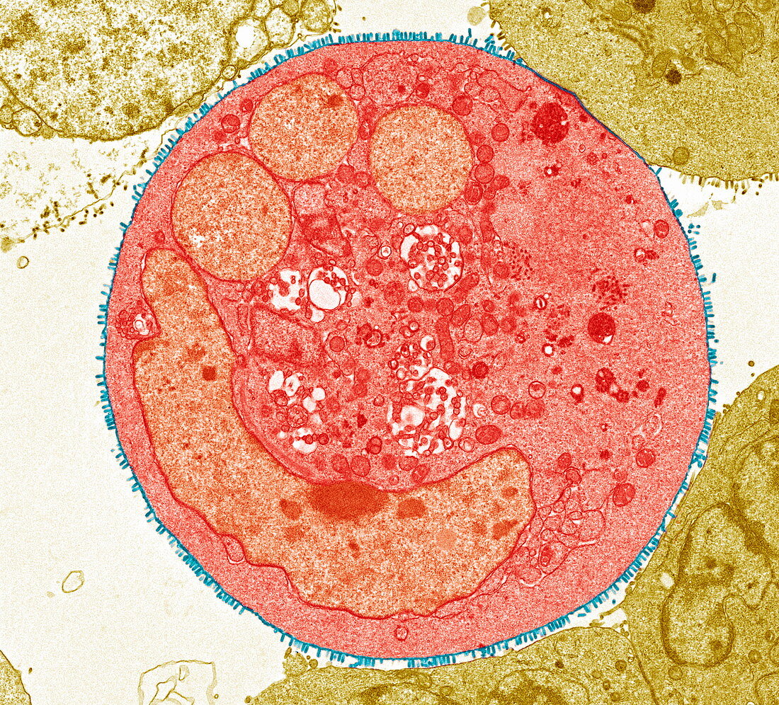 Vesicular stomatitis virus,TEM