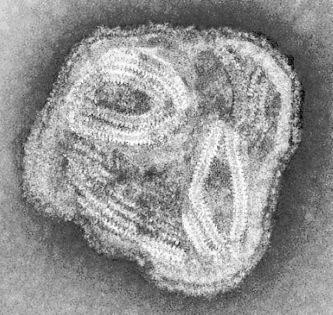 Paramyxovirus particle,TEM