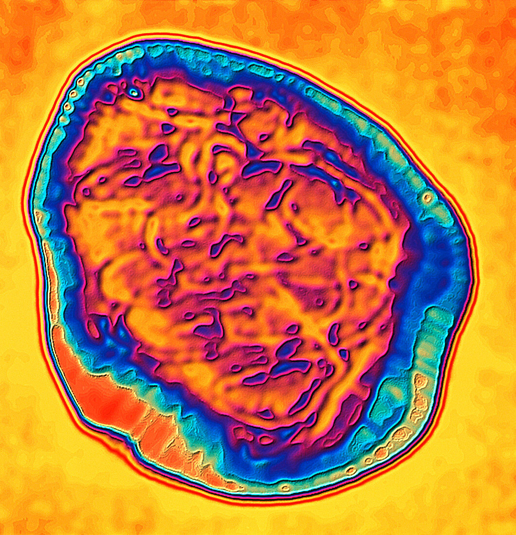 Coloured TEM of the measles virus (morbilli-virus)