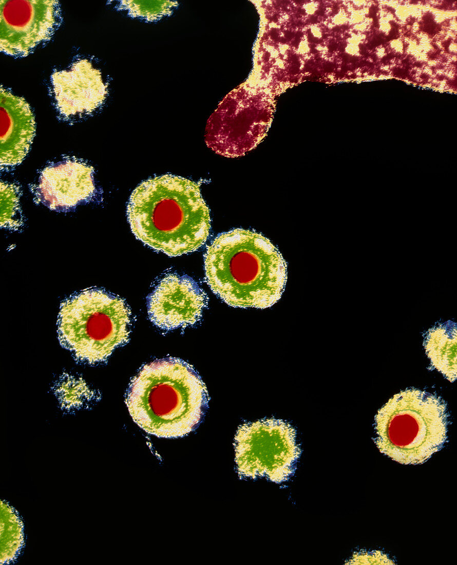 Coloured TEM of HHV6 viruses infecting a cell