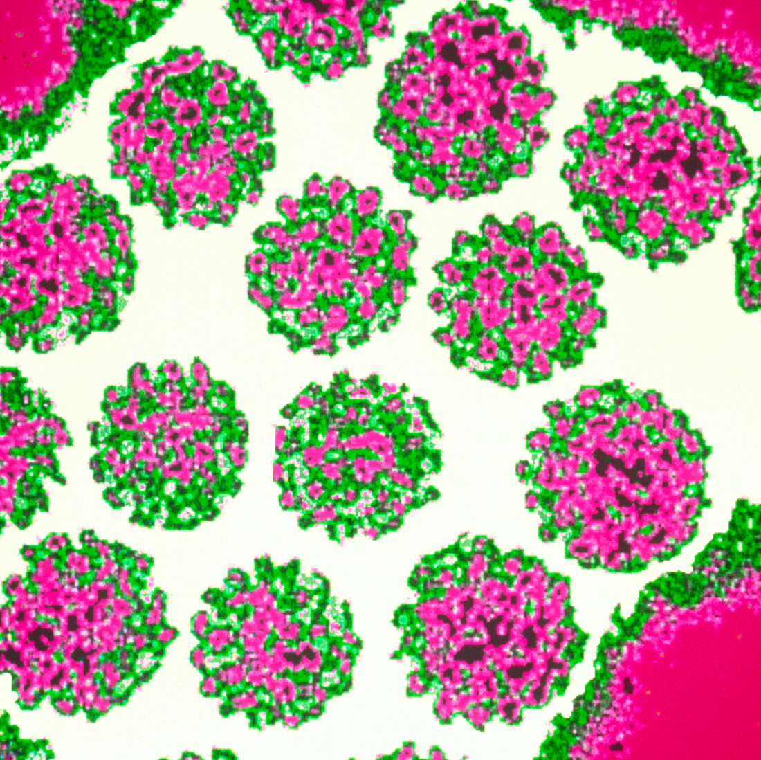Coloured TEM of Papilloma viruses