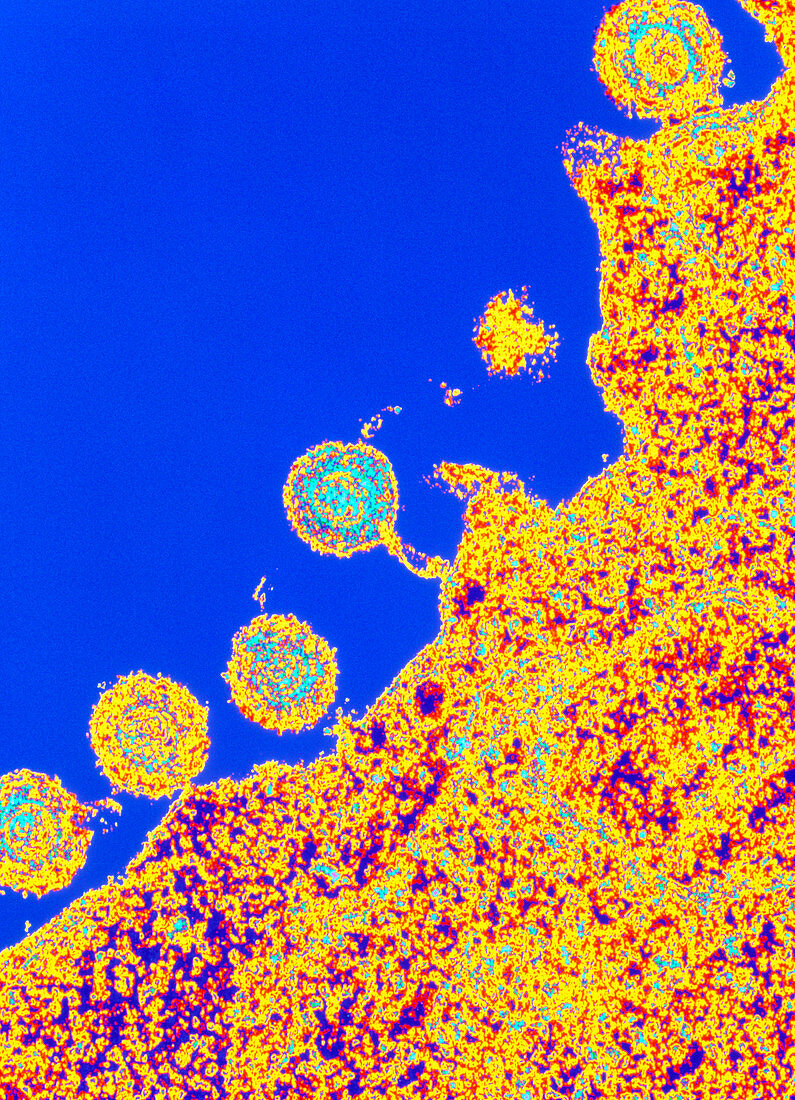 Coloured TEM of HHV6 viruses infecting a cell