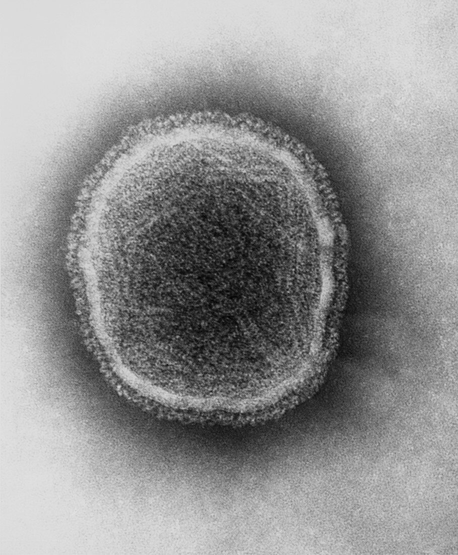 TEM of a parainfluenza virus,cause of croup