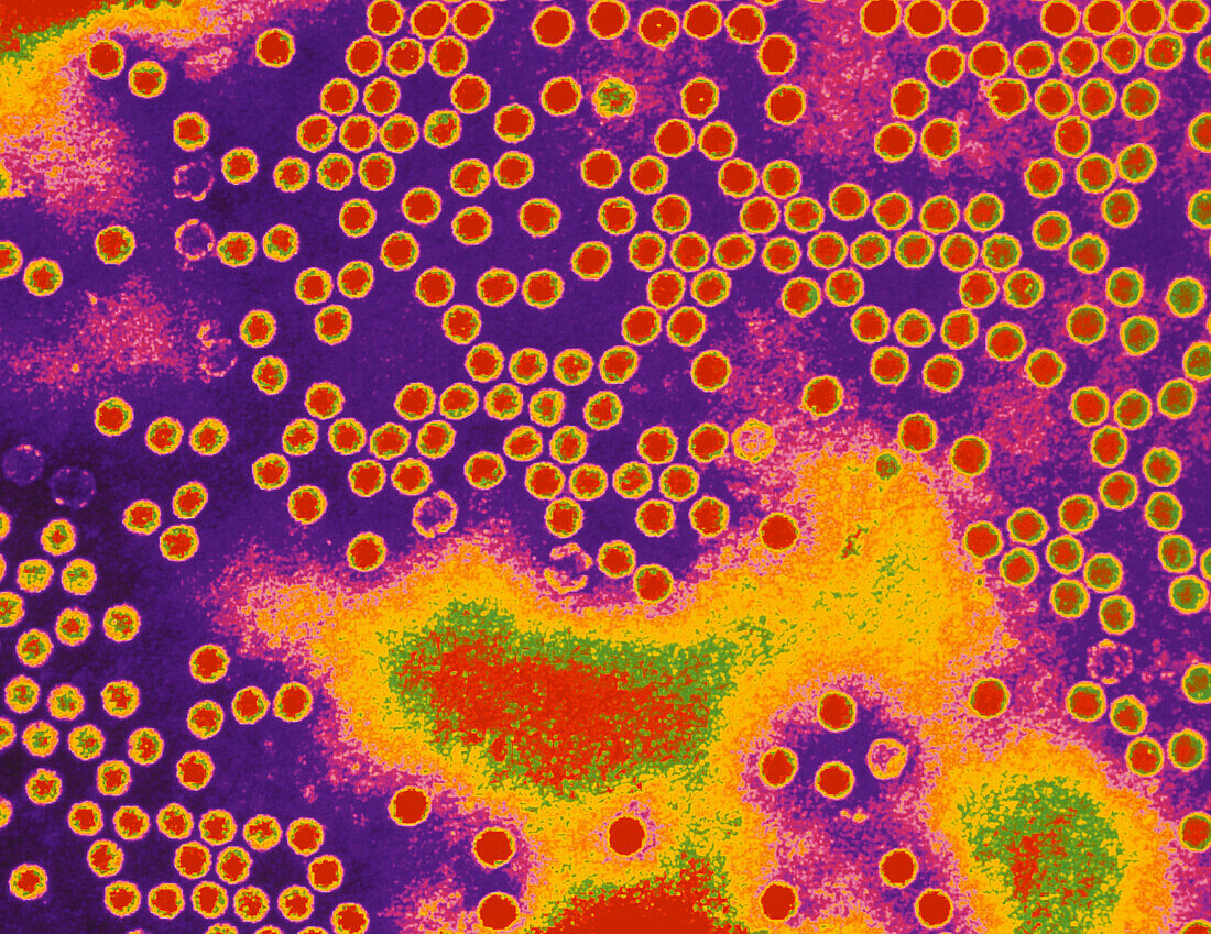 Coloured TEM of clusters of polio viruses (type 1)