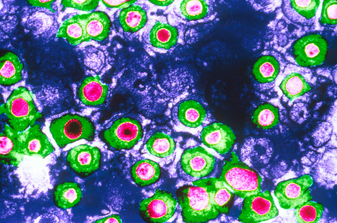 Coloured TEM of herpes simplex viruses