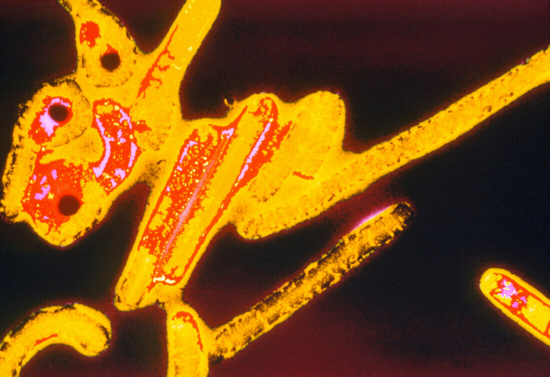 Coloured TEM of Ebola viruses