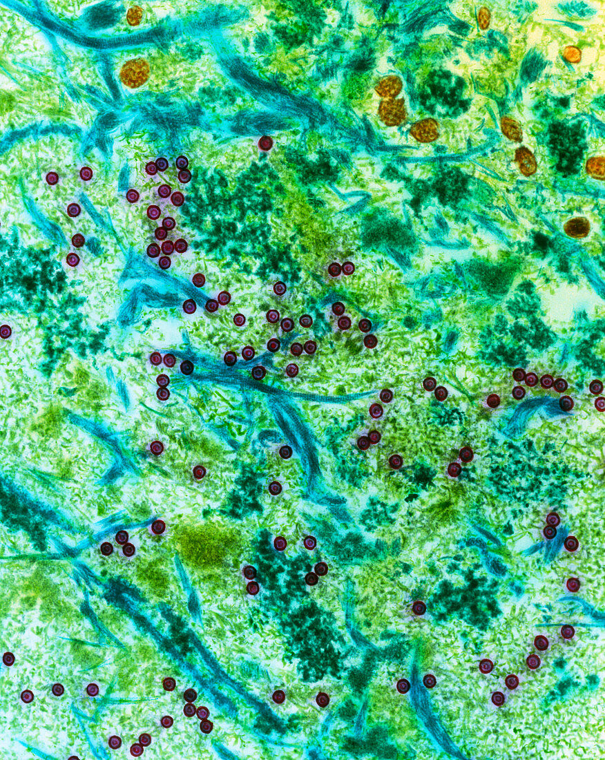 Coloured TEM of Cytomegaloviruses in a lung cell