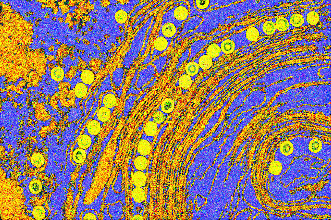 Coloured TEM of herpes simplex viruses inside cell
