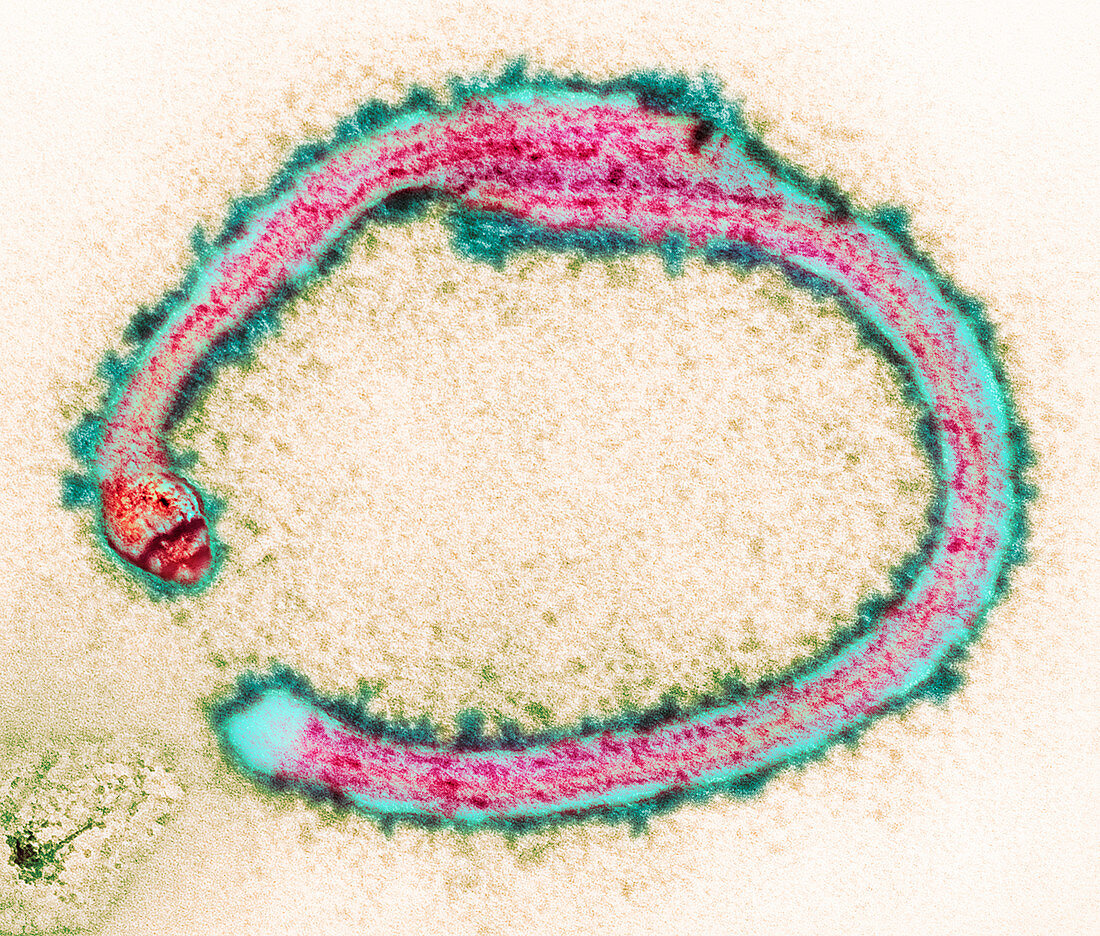 Ebola virus particles,TEM
