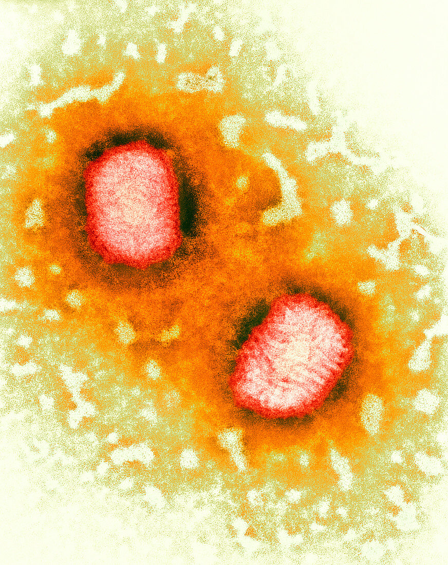 Molluscum contagiosum virus,TEM