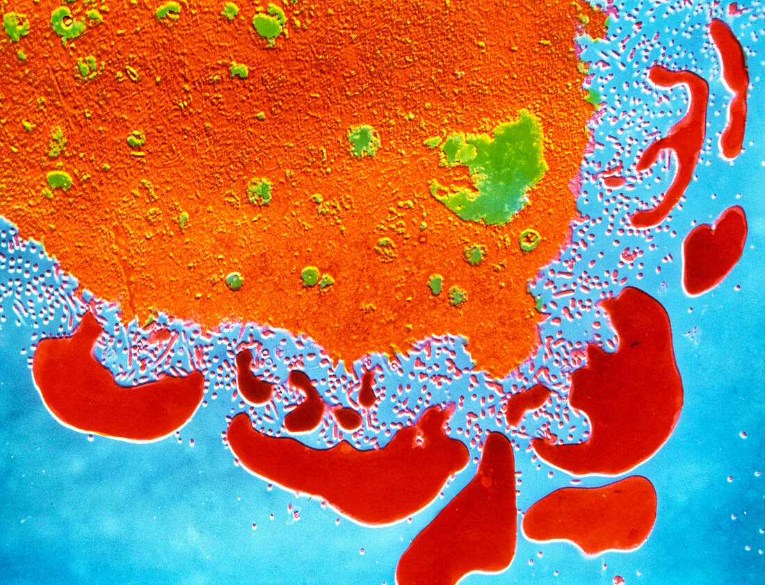 False-col TEM of coronaviruses on red blood cells