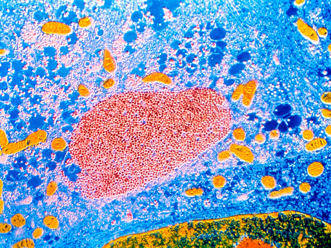 False-colour TEM of a coronavirus inclusion body