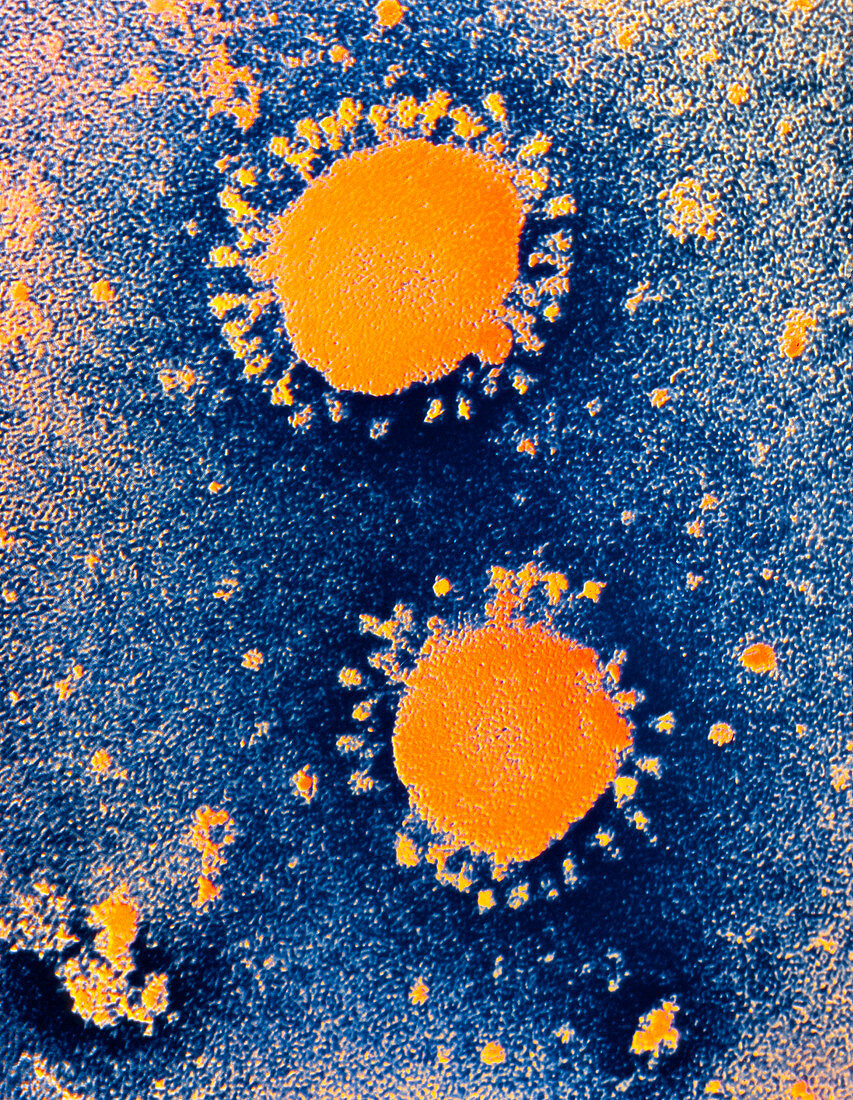 Coloured TEM of coronaviruses